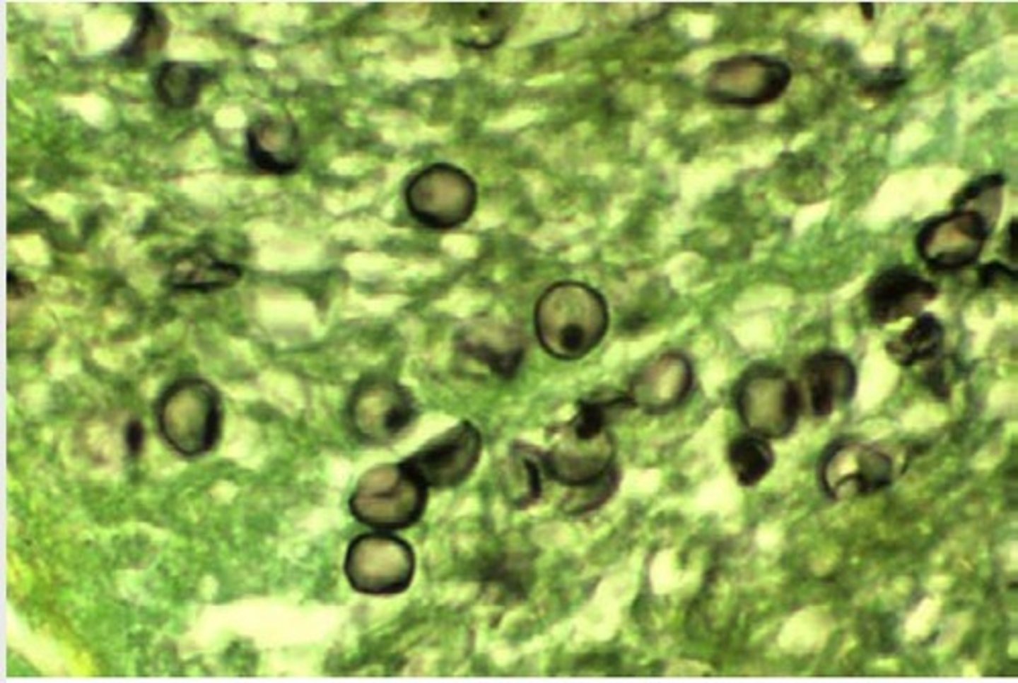 <p>a. Pneumocystis jiroveci</p>