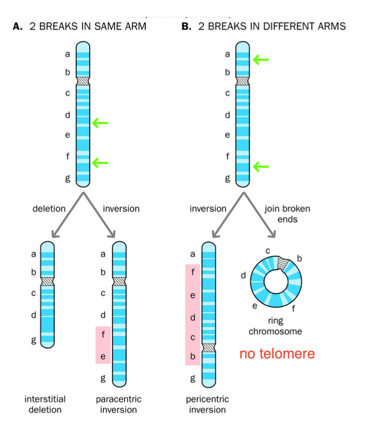 <p><strong><u>INVERSION = 2 BREAKS</u></strong></p><p>Para = same arm</p><p>Peri = different arms</p><p>centromere</p><p>Dicentric - chromosome has 2 centromeres - (Joining of 2 segments) - mitosis - chromosome strain - bridge -fusion - break</p><p>Acentric - chromosome LOST its centromere - lost during meiosis- unable to separate in sister chromatids</p><p></p><p>2 BREAKS on one chromosome</p><p>-Incorrect repair of break + NO LOSS OF MATERIAL</p><p>-Paracentric / pericentric inversions</p><p></p><p></p><p>Paracentric - inverted segments DOES NOT contain the<strong> centromere</strong></p><p>-Broken segment <strong>FLIPS</strong> but stays within the s<strong>ame arm of the chromosome</strong></p><p>-No change in genetic information, BUT THE ORDER OF THE GENES IS CHANGED</p><p>-Can cause problems during mitosis - IF CROSS OVERS occur - dicentric / acentric chromosomes may arris</p><p></p><p>Pericentric - inverted segment contains the centromere</p><p>Inversion on different arms - centromere included</p><p>Gene order is altered, no genetic material is lost</p><p>Crossing over leads to DUPLICATIONS AND DELETIONS IN CHROMOSOMES</p><p>-misalignment during meiosis</p><p>Unbalanced chromosomal rearrangements in offspring</p><p>Congenital abnormalities</p><p>-GAMETES fail to fertilise</p><p></p><p>INVERSION RESULTS IN 2 BREAKS</p><p>Paracentric - breaks are on the same arm</p><p>Pericentric - breaks are on different arms.</p><p></p><p></p><p>Structural variants </p><p>Mis-repair of breakages</p><p>-Centromeres - acentric / dicentric - para / peri (arms / centromeres included)</p><p></p><p>Loss of telomeres - formation of RING CHROMOSOME  </p><p>-Ends of chromosome fuse together </p><p>-Loss by EXTREME SHORTENING </p><p>Associated with intellectual disabilities, growth delays + congenital effects </p>