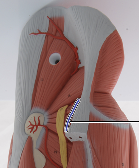 <p>supplies blood to glutes</p>