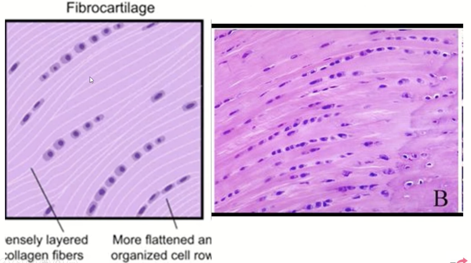<p>fibrocartilage</p>