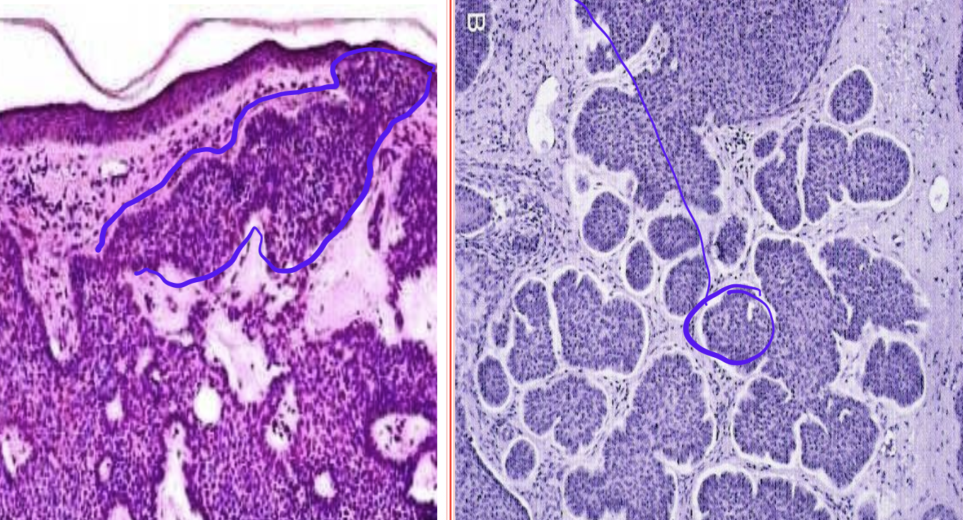 <p>Identify the <strong>organ</strong> and the <strong>diagnosis</strong> in this format: <em>diagnosis, organ</em></p>