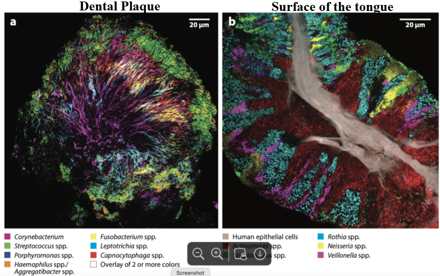 <ul><li><p>it is mainly because of the metabolic interactions present in the plaque</p></li><li><p>the prevalence of virulence factors&nbsp;</p><ul><li><p>adherence factors on the bacteria</p><ul><li><p>not all can bind to a specific surface or each other&nbsp;</p></li></ul></li></ul></li></ul><p>*when testing for identification of present bacteria, will get different signatures depending on site, see image for examples</p>