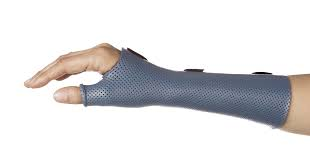 <p>C5 hand splint with wrist in neutral, thumb placed in opposition in PINCH position, used to stabilize objects in functional tasks </p>