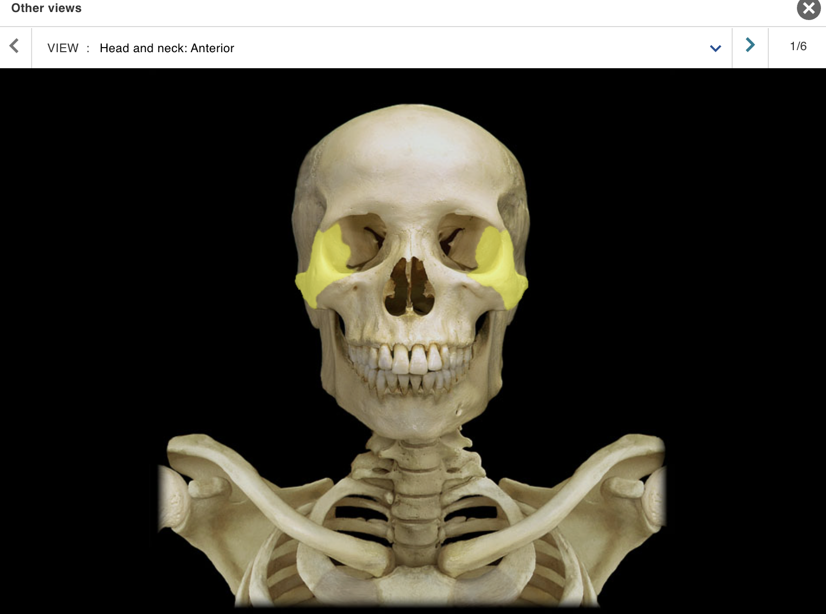 <p>Location:</p><p class="p1">• Skull (anterior and lateral)</p><p class="p1">Description:</p><ul><li><p>﻿﻿Paired, irregular-shaped bone</p></li><li><p>﻿﻿Temporal process contributes to zygomatic arch</p></li></ul><p class="p1">Also known as:</p><p class="p1">• "Cheekbone"</p><p class="p1">Comment:</p><p class="p1">• Forms part of floor and lateral wall of orbit</p>