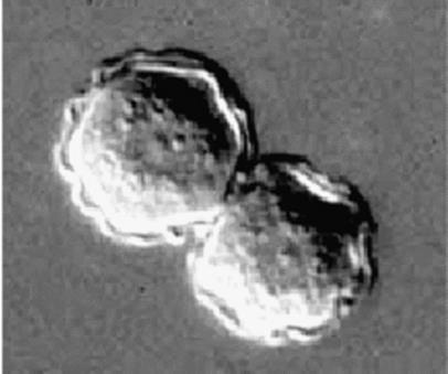 <p><strong>Identify the parasitic stage.</strong></p><div data-type="horizontalRule"><hr></div><p><strong>Mention two morphological characteristics of this stage.</strong></p><div data-type="horizontalRule"><hr></div><p><strong>Mention the possible human samples used for diagnosis, and the culture medium used.</strong></p><div data-type="horizontalRule"><hr></div><p><strong>Mention the diagnostic methods used for ocular infection caused by this parasite</strong></p>