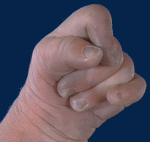 term image