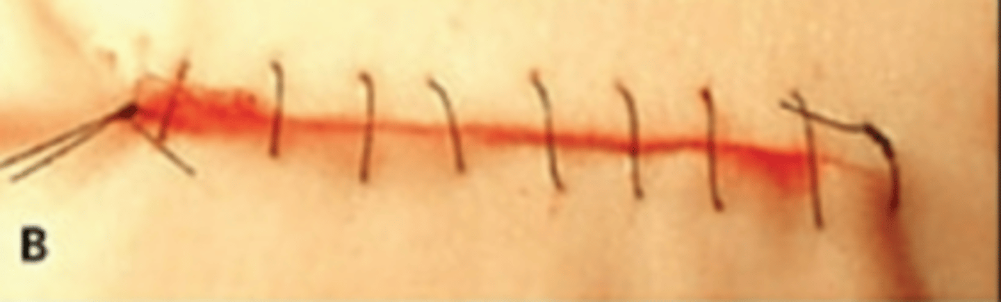 <p>-a single strand of suture placed as a serious or sticks down the length of the incision</p><p>-not ideal for wounds under tension</p><p>-tied at each end of the incision</p><p>-various types of techniques</p><p>-if any portion of the stick breaks, the entire closure is jeopardized</p>