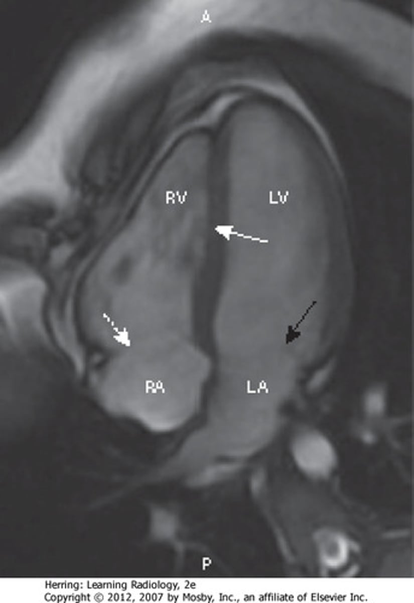 <p>electrocardiograms, x-rays, echocardiograms, blood tests, coronary angiography, MRI scans</p>