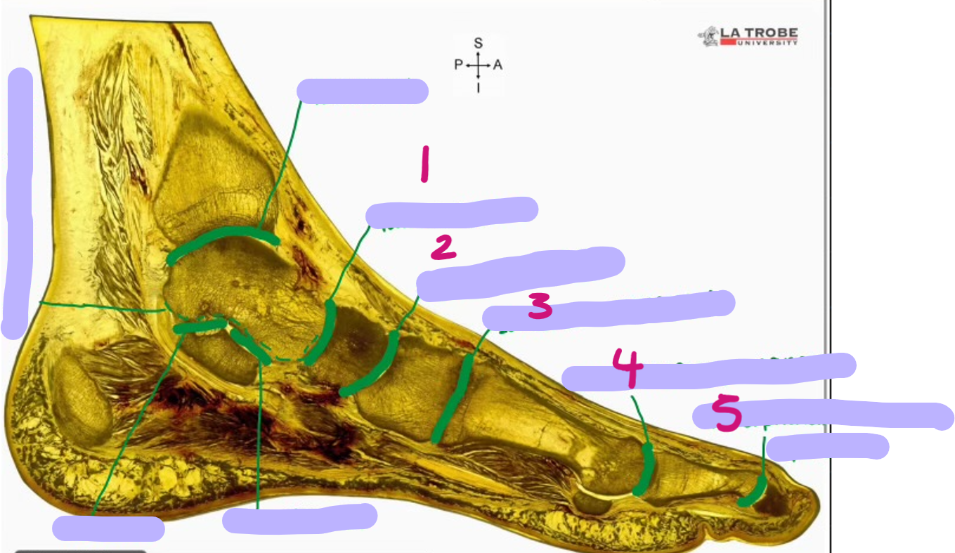 <p>identify these joints</p>