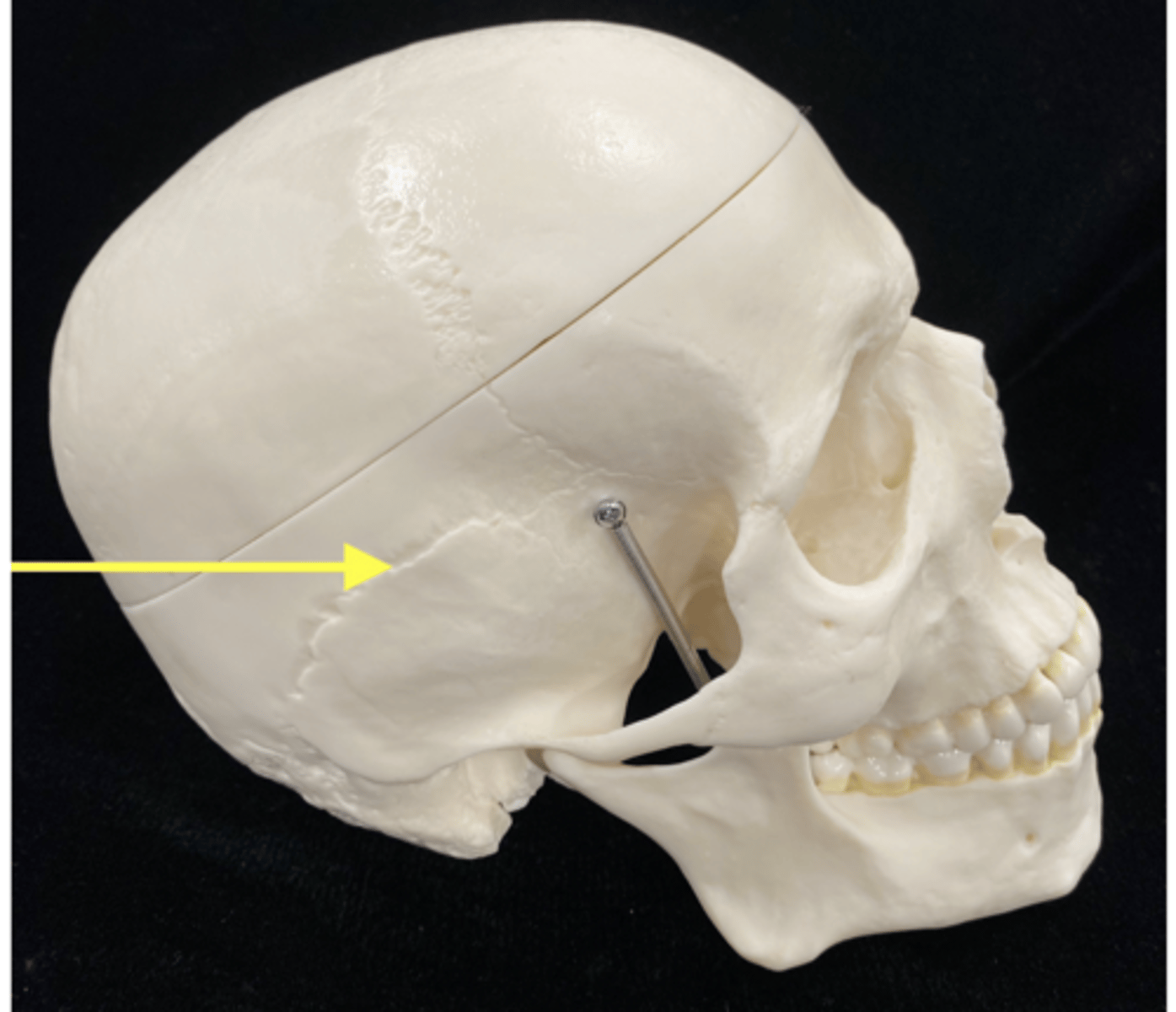 <p>name the suture </p>