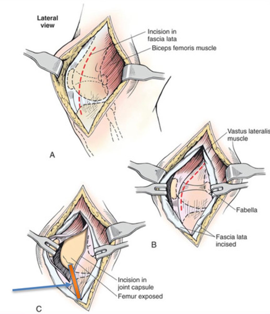 <p>When doing a lateral approach to the stifle when repairing patellar luxations, what structure do we need to be aware of in order to avoid damaging it?</p>