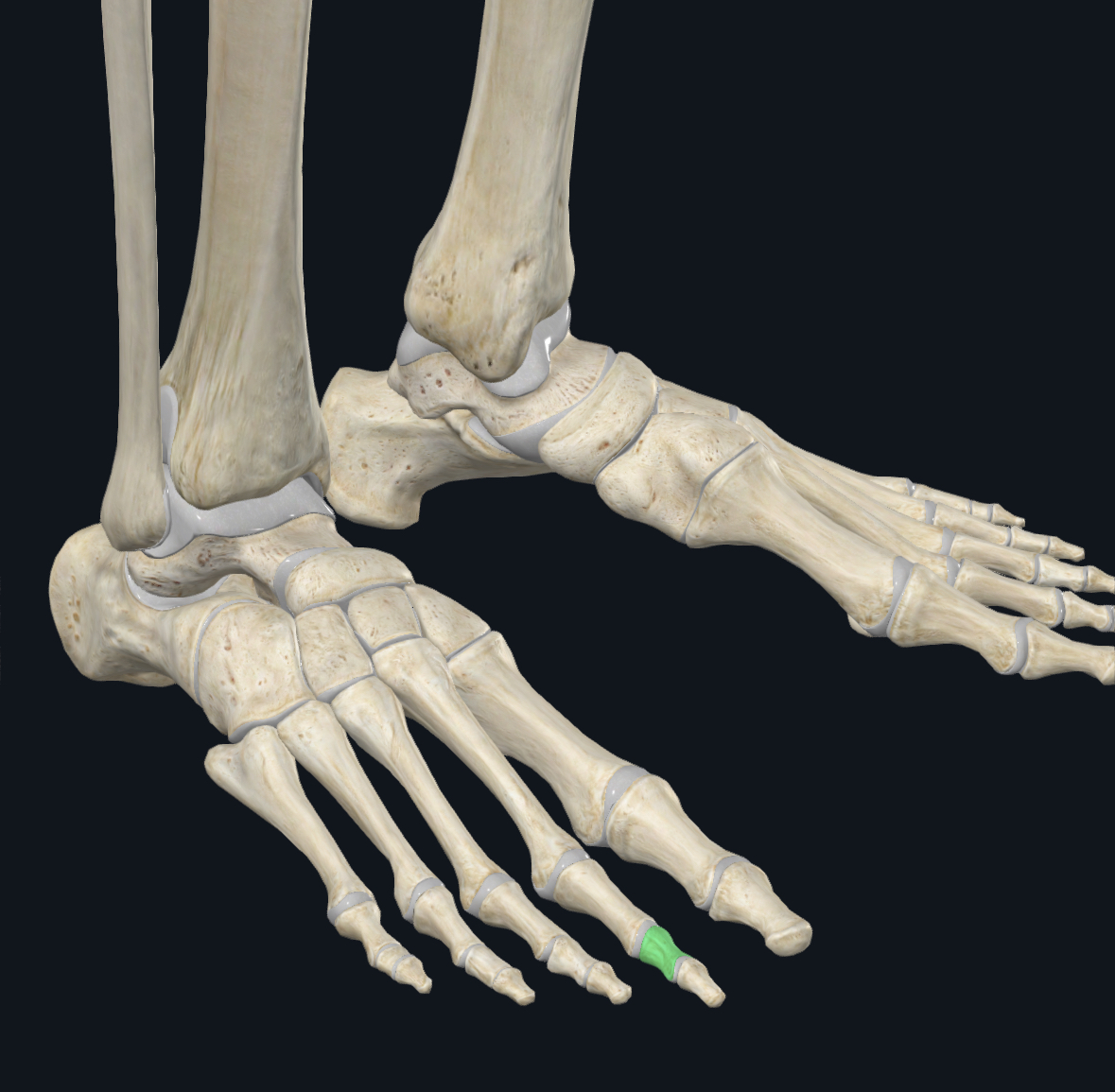term image