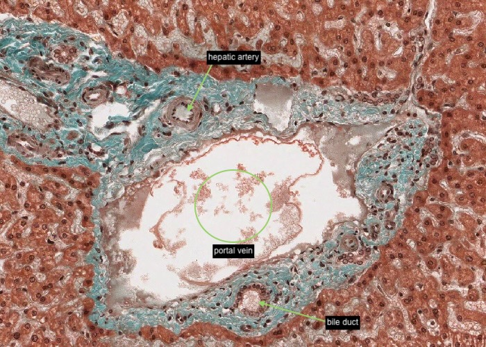 Liver (Masson) - portal triad