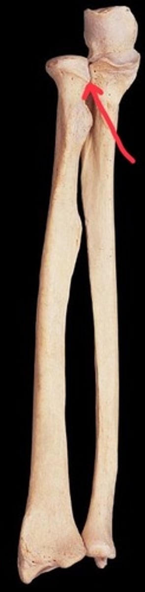<p>proximal radioulnar joint</p>