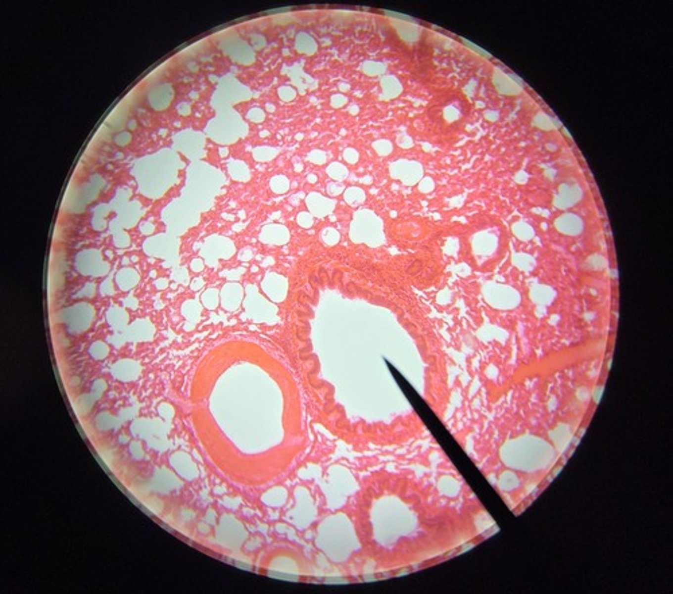 <p>What is this structure? (NOTE that it doesn't have hyaline cartilage</p>