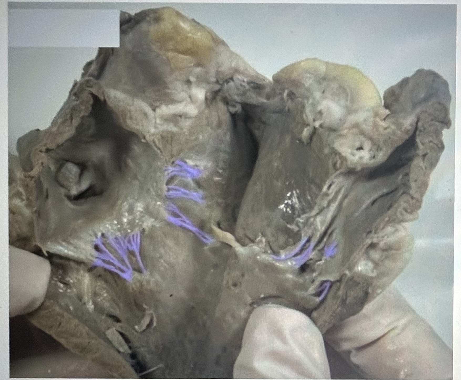 Identify the highlighted sheep heart structure. 