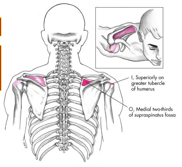 rotator cuff muscle 

actions: abduction 