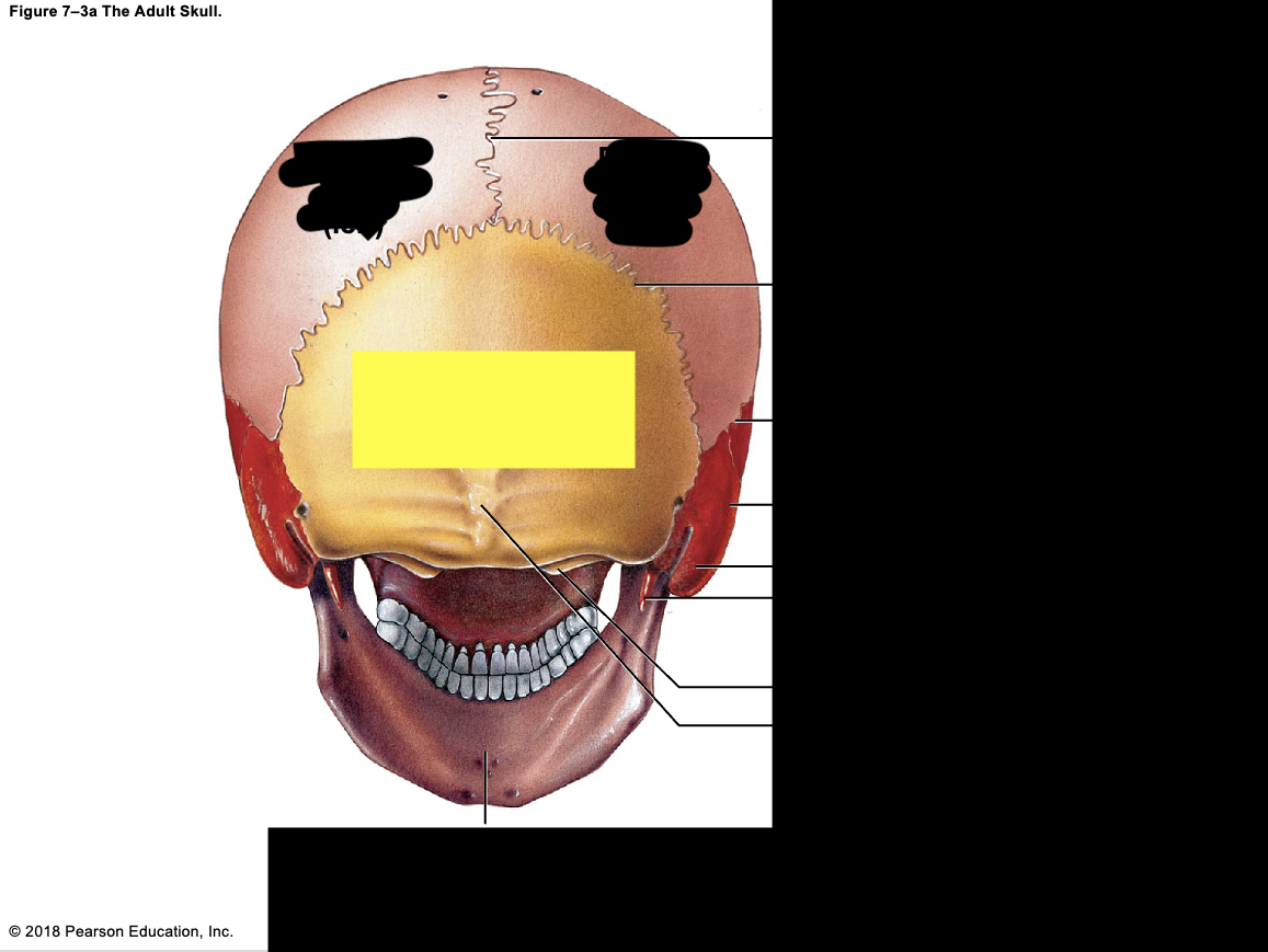<p><strong>(1) </strong>occipital ; <strong>base of skull</strong></p>