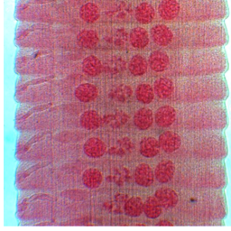 Proglottids of _________ stained with ___________. Notice the form of the proglottids.