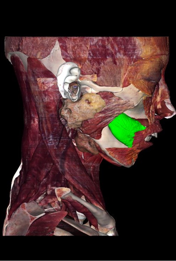 <p>origin: maxilla and mandible</p><p>insertion: orbicularis oris</p><p>innervation: CN VII</p><p>action: <strong>resist dissension when blowing/whistling</strong>, active in smiling, keep food between teeth, active during sucking, blowing, whistling, press cheek against molar teeth</p>