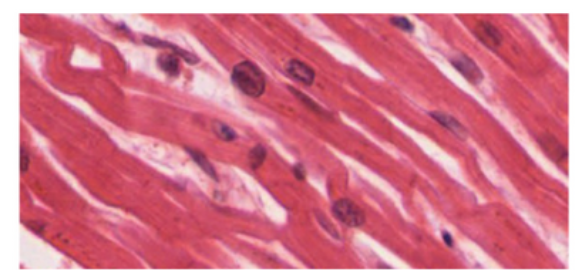 <p>Single nucleus and appear striated</p>