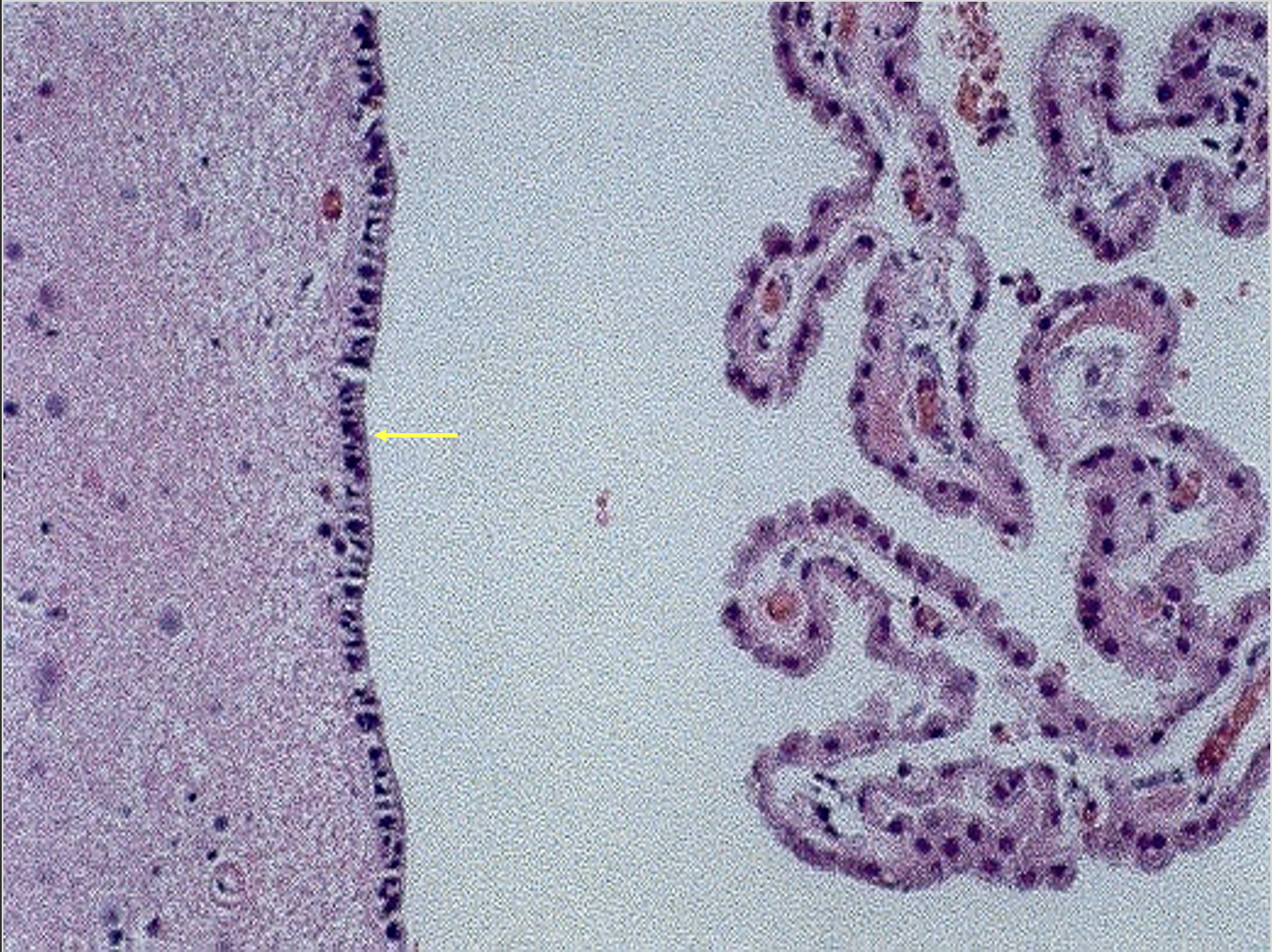 term image