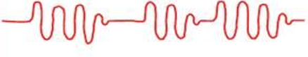 <p>(chest &amp; lungs)</p><ul><li><p>respiration patterns:</p><ul><li><p>description: <span>irregular pattern characterized by varying depth and rate of respirations followed by periods of apnea</span></p></li><li><p>clinical indication: <span>may be seen with meningitis or severe brain damage</span></p></li></ul></li></ul><p></p>