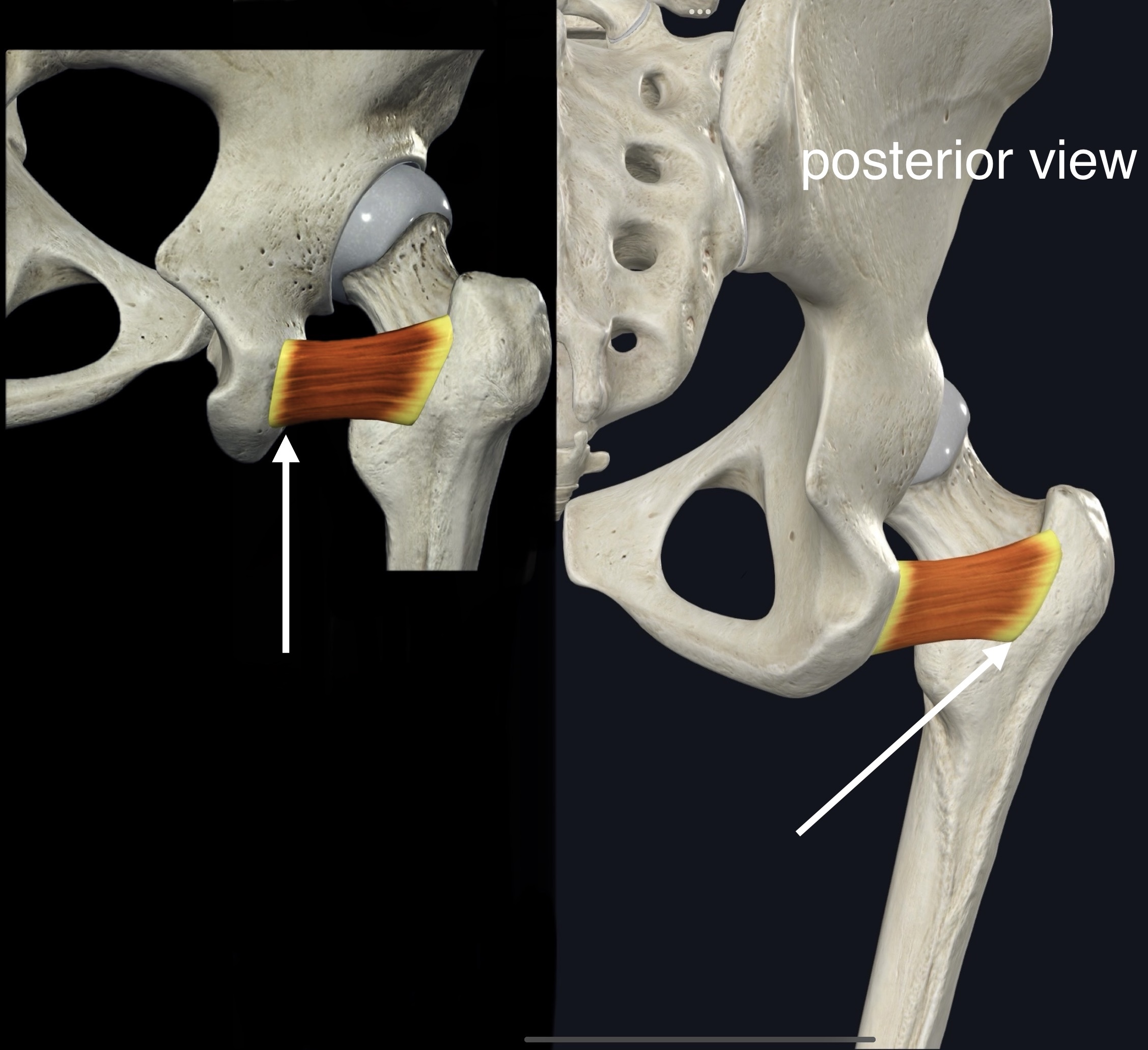 <p>Name the muscle, origin and insertion</p>