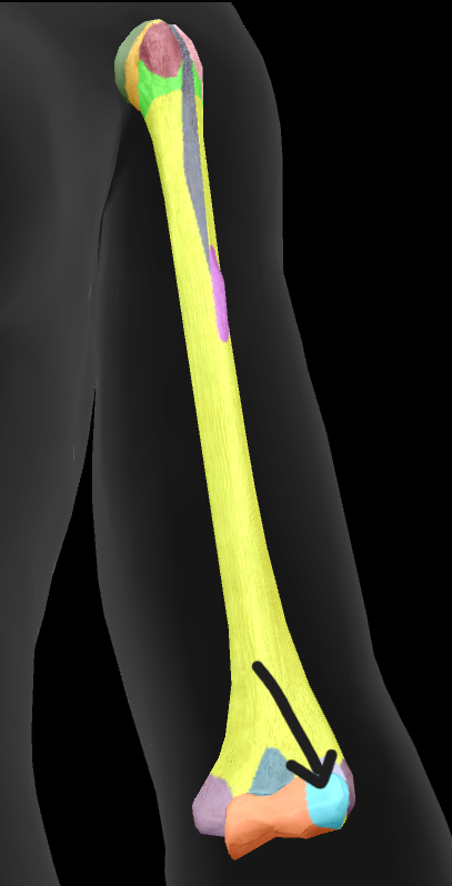 term image
