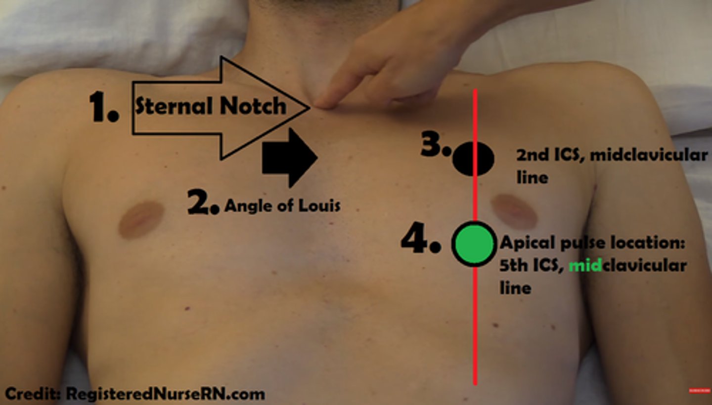 <p>Between the fifth and sixth ribs, at the left midclavicular line</p>