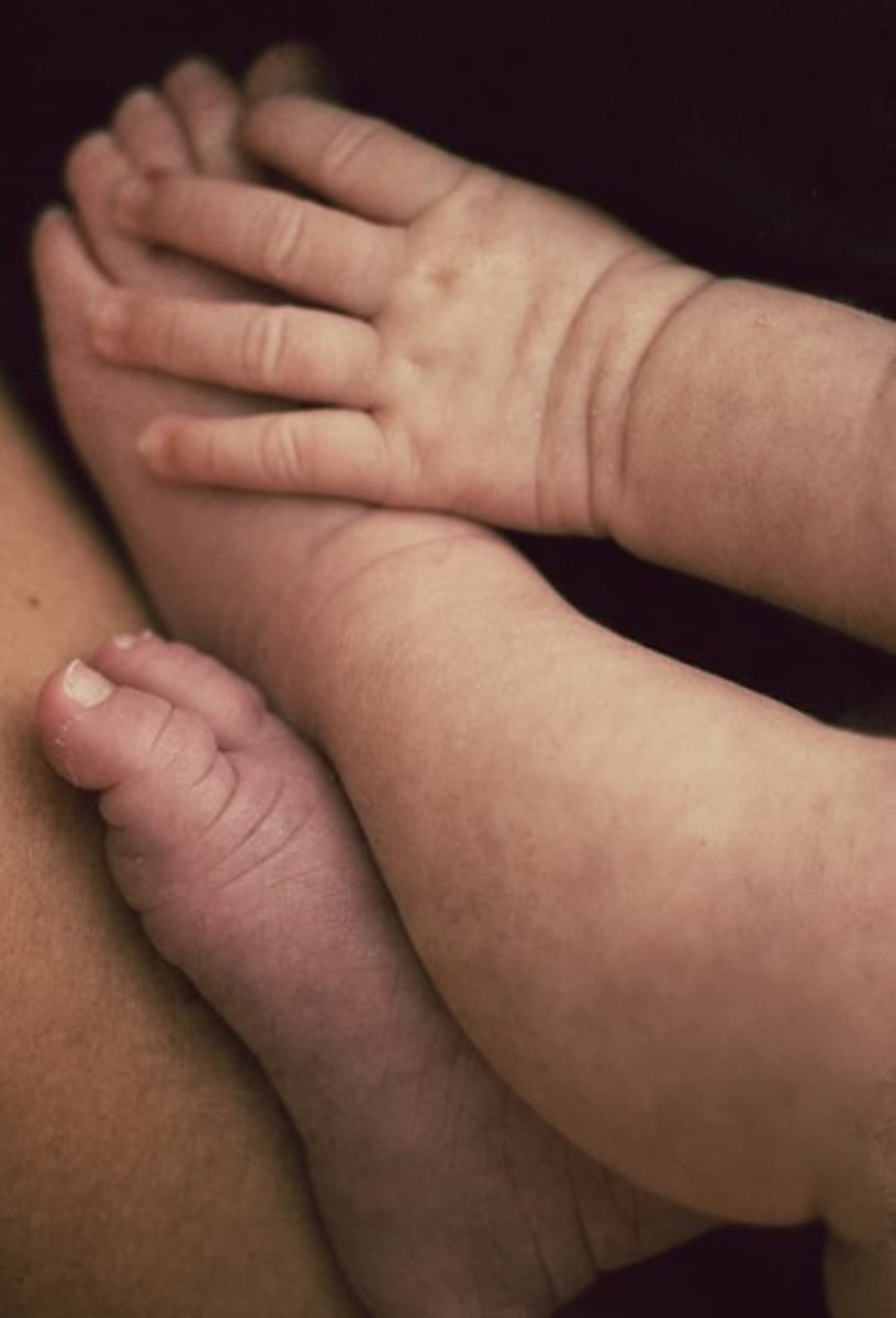 <p>Fingers or toes</p>