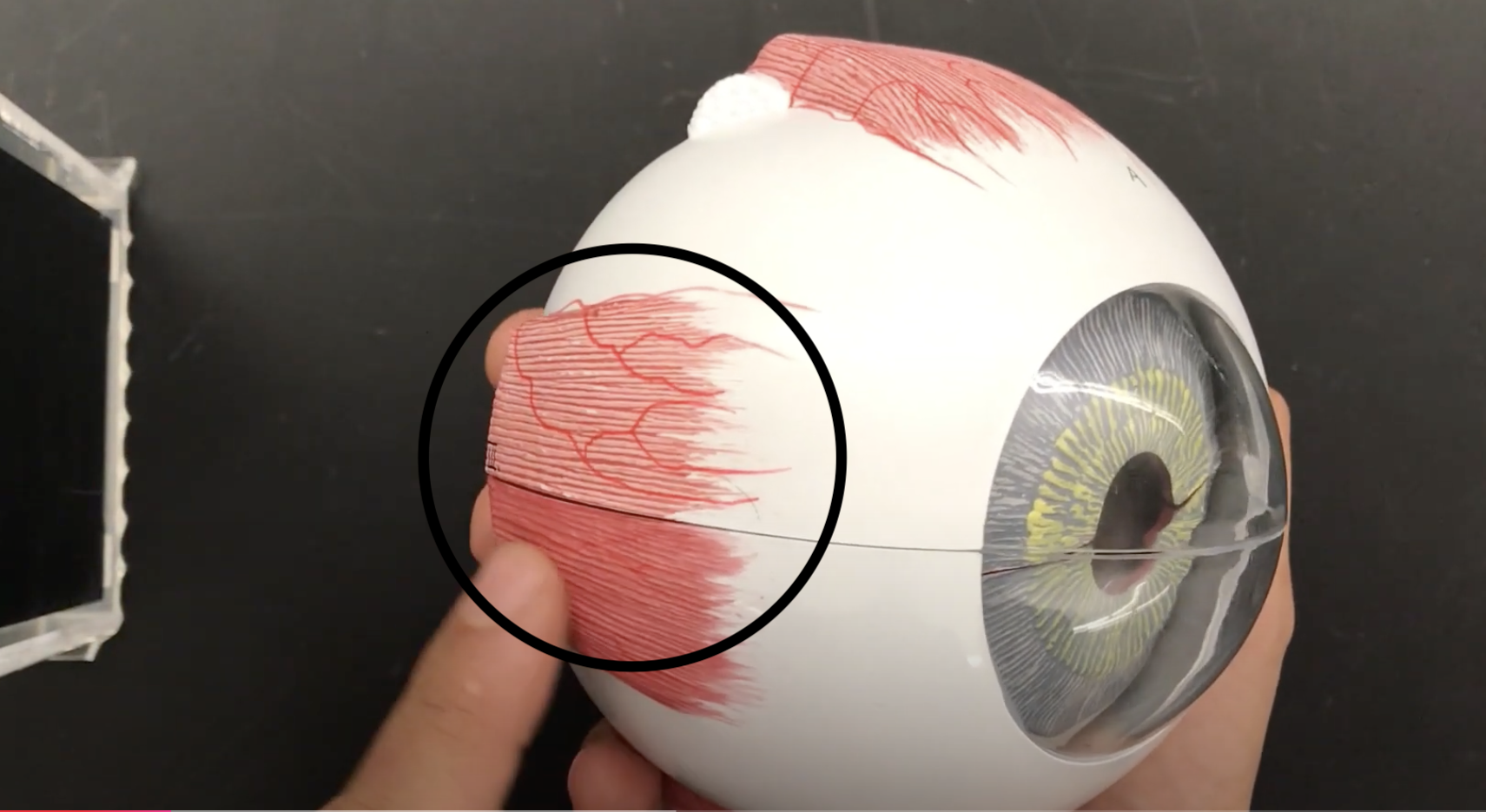 <p>What muscle is this?*****</p>