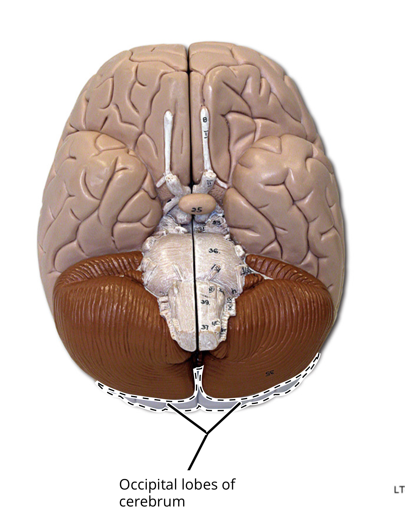 <p>occipital lobe</p>