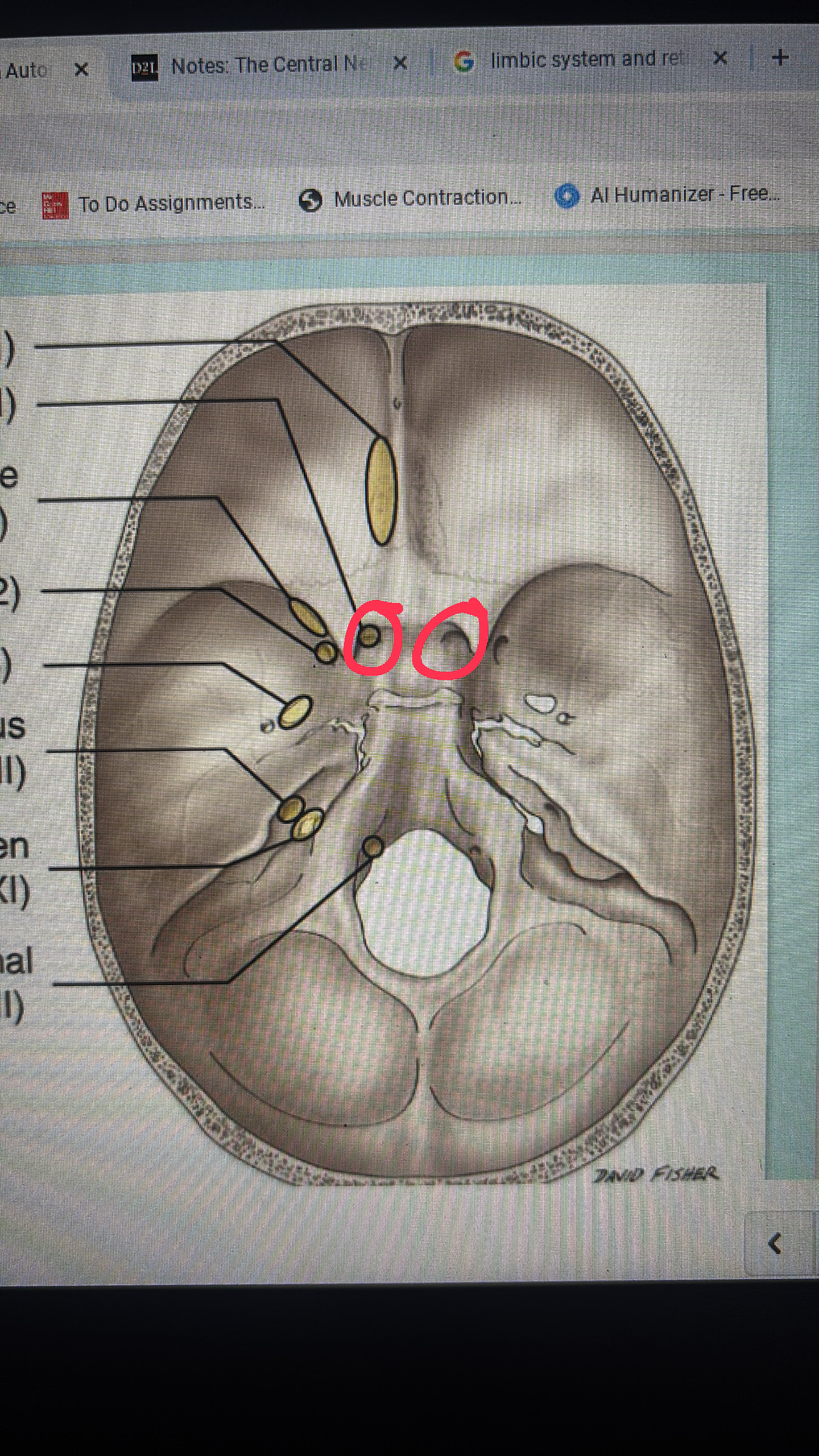 <p>cranial nerve II</p>