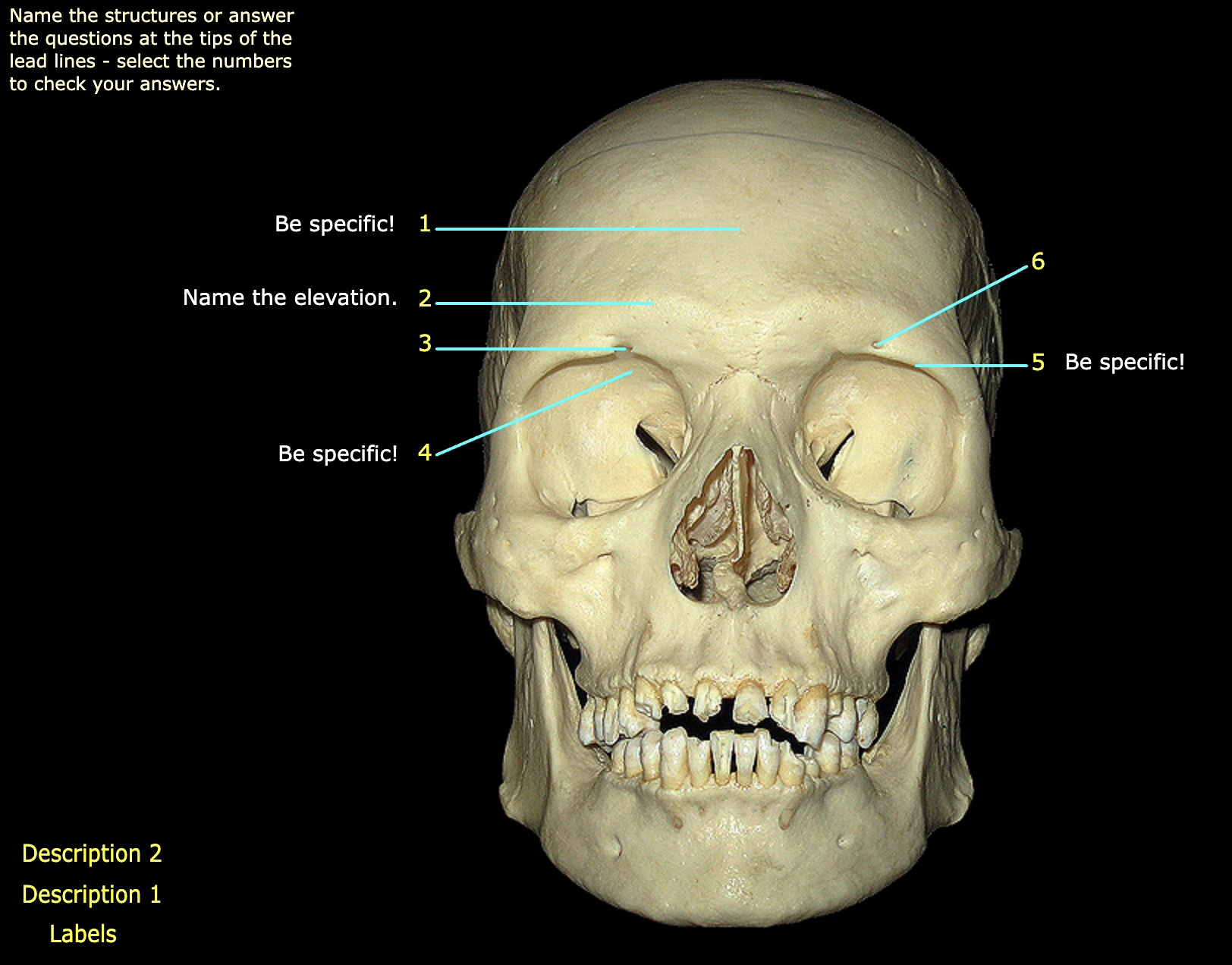What structure is labeled 1?