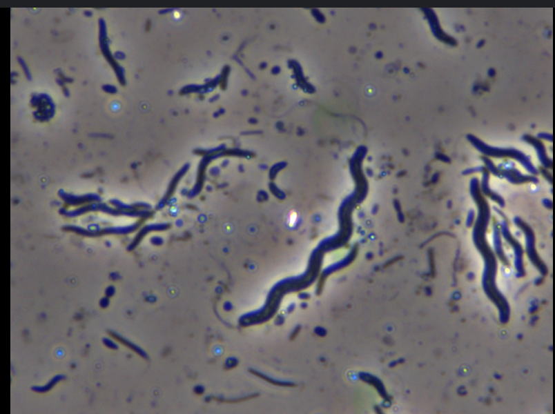 <p>Spiral wiggly rod shape</p>