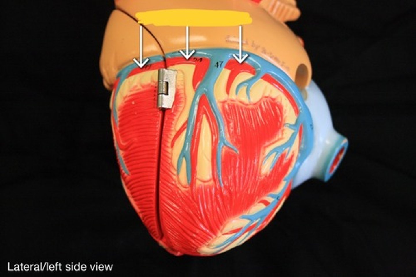 <p>Coronary arteries and their branches,</p>