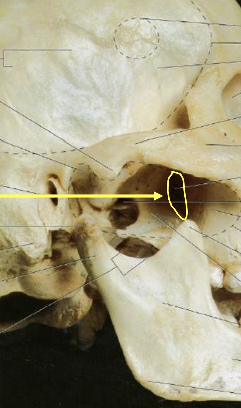 <p>what structure is circled in yellow?</p>