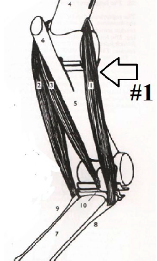 <p>What is this muscle? What joints does it move? Where does it originate and insert? (1)</p>