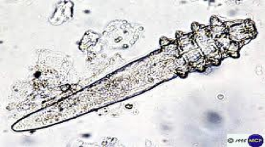 <p>what kind of mite</p>