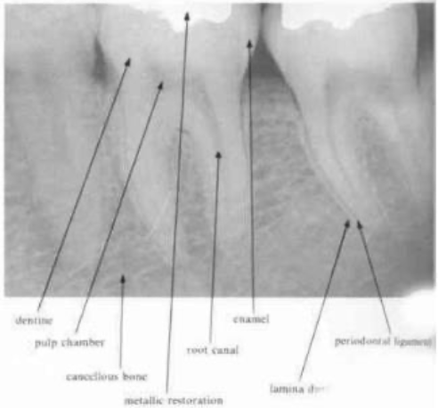 <p><span>enamel → most radiopaque structure</span></p><p><span>dentin → should be uniform in density</span></p>