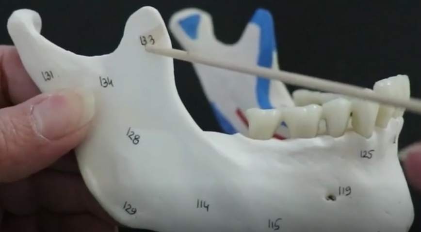 a projection of the mandible to which  muscle moving the mandible upward attaches

* the space where her right finger is pointing 