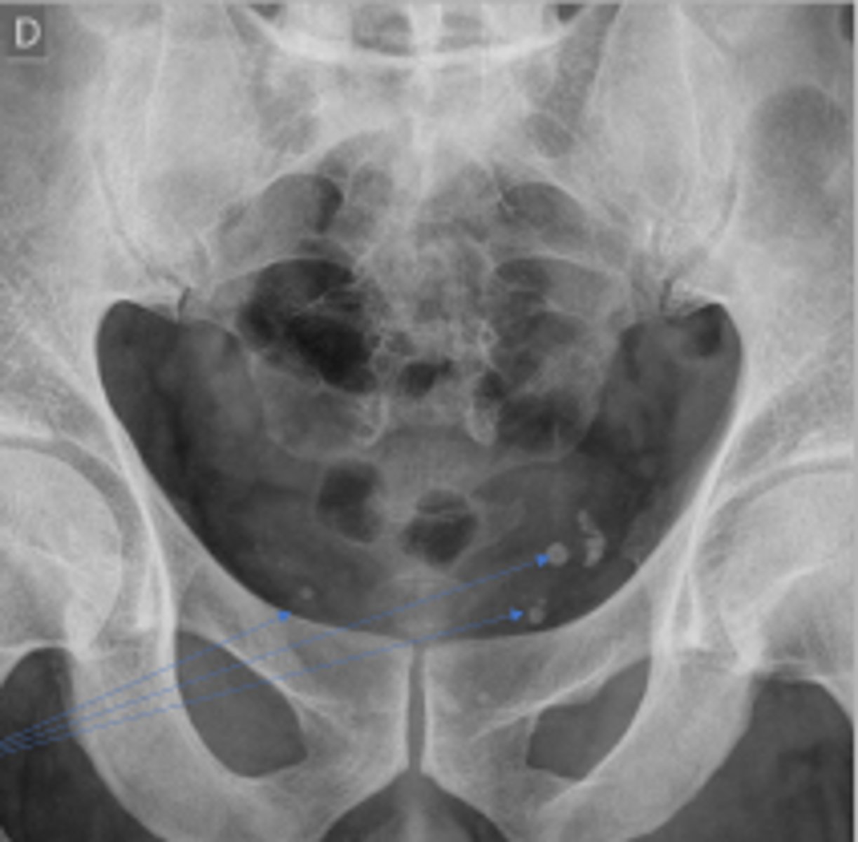 <p>What are the arrows pointing to?</p>