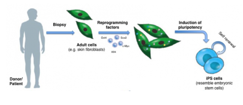 <p>What is microcephaly and why would it need to be modelled using in vitro cell engineering?</p><p>How are iPSCs used for <em>in vitro</em> disease modeling? Use the case study of microcephaly to explain the workflow and its potential applications.</p>