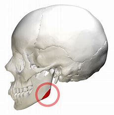 <p>What bone structure is the highlighted area?</p>