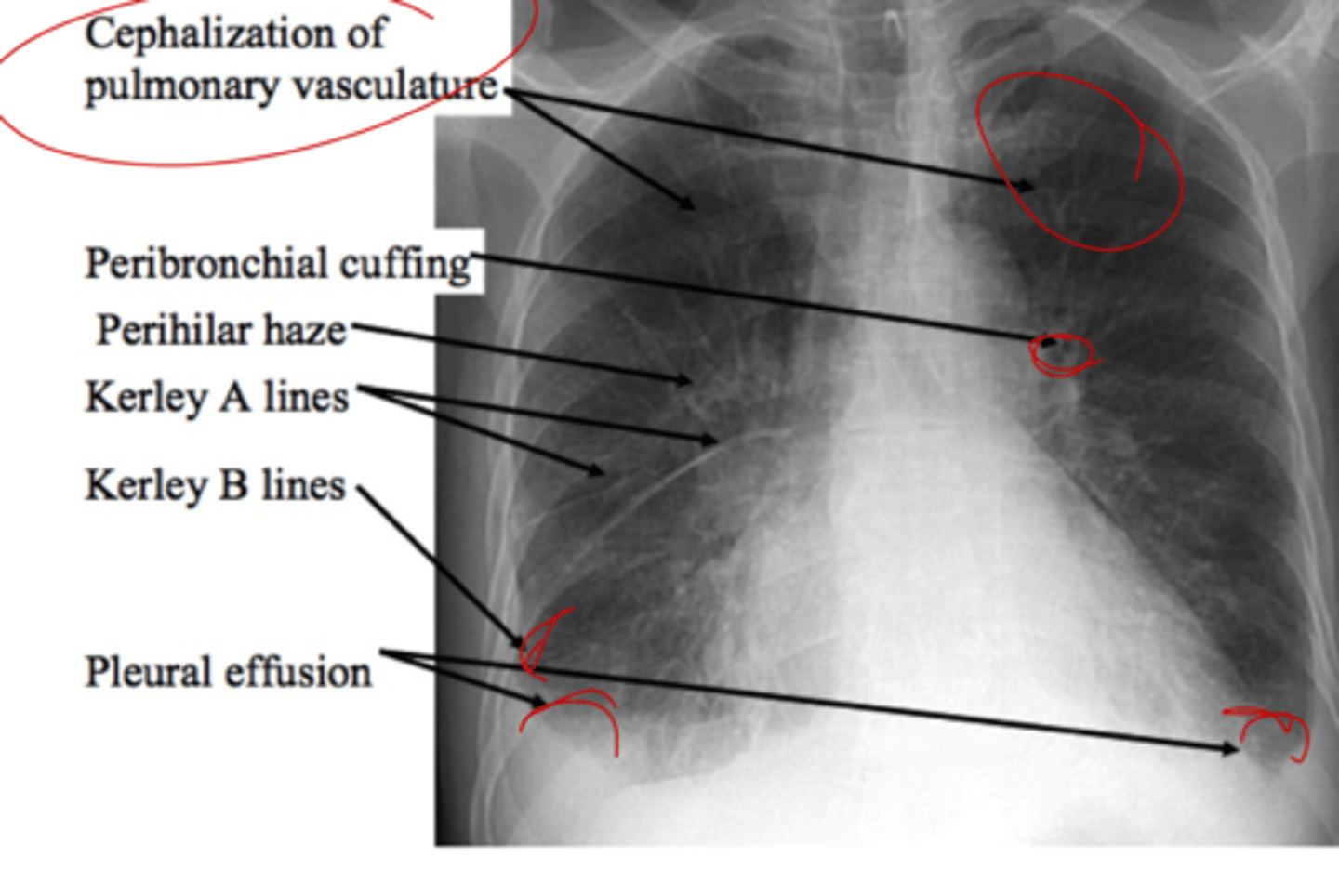 <p>what are all of these indicative of?</p>