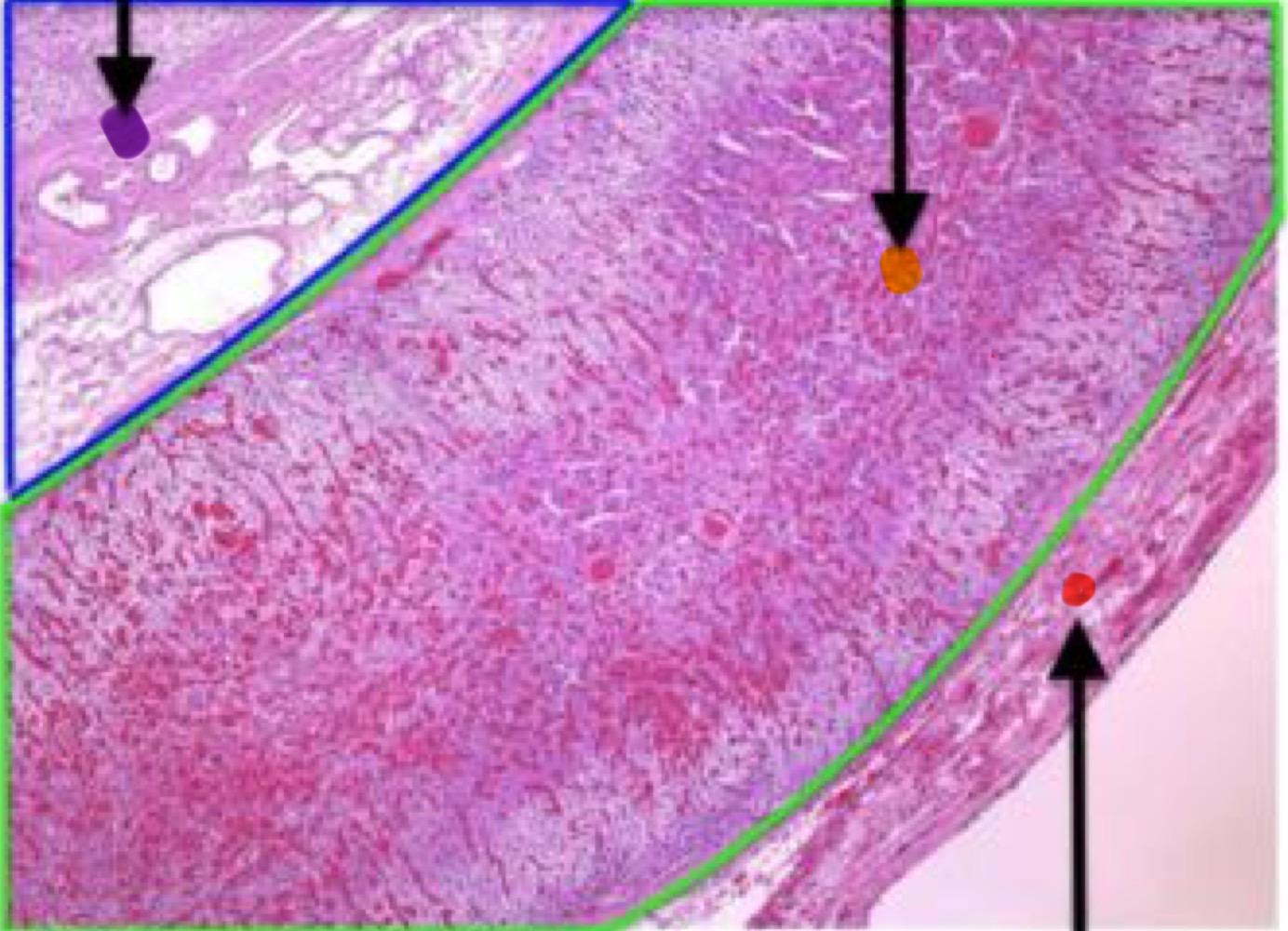 <p>Adrenal Capsule</p>