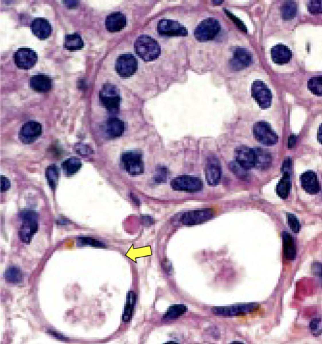 <p>Classify the epithelium indicated by the arrow</p>