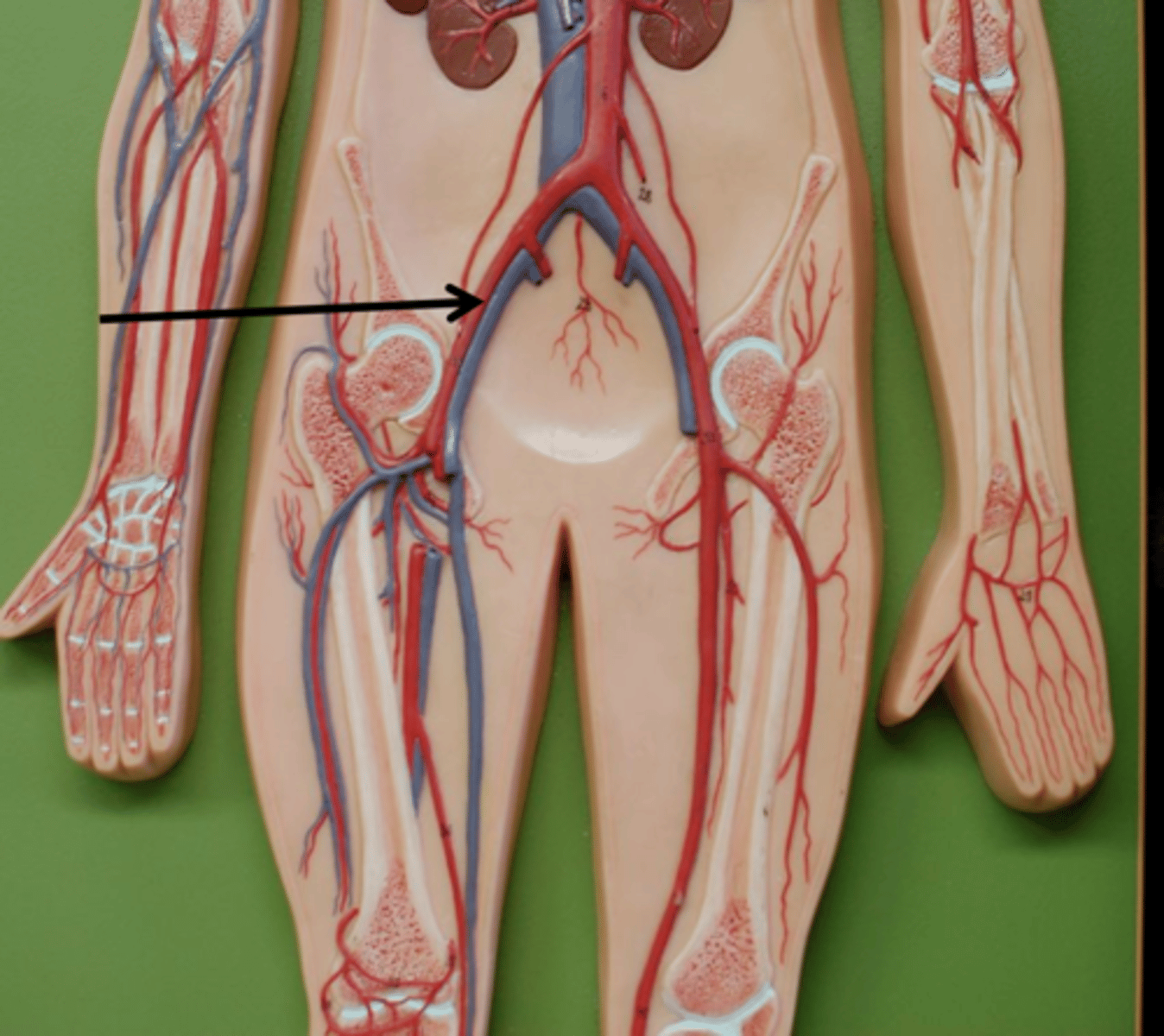 <p>Name the blood vessel.</p>