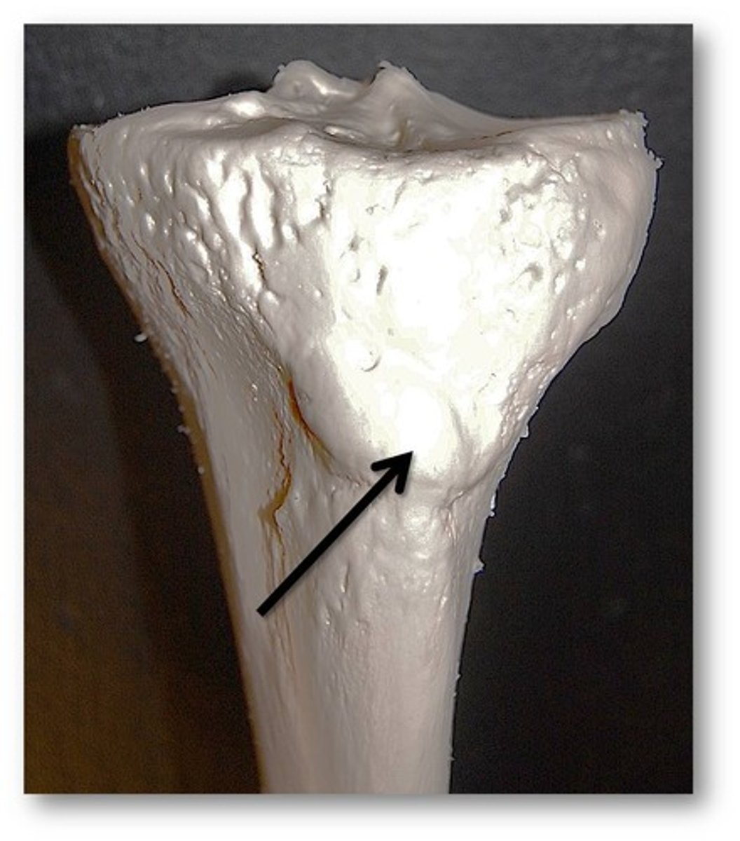 <p>Name this specific part of the tibia.</p>